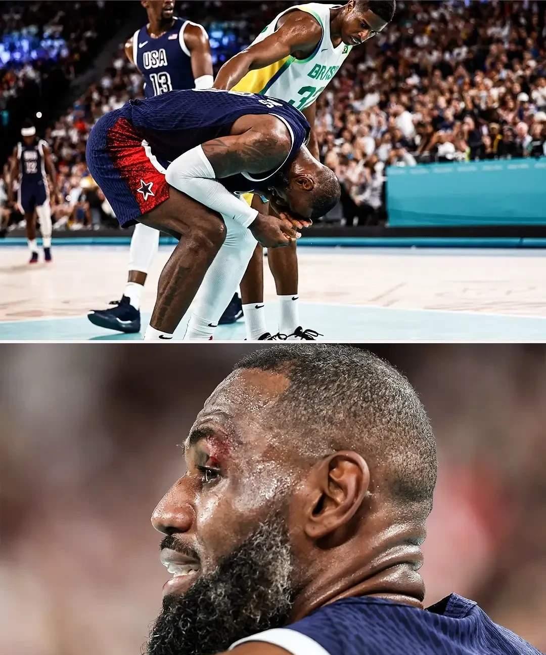 法国队带队取胜!,詹姆斯重要时刻战术调整再创辉煌时刻 法国队带队取胜!,詹姆斯重要时刻战术调整再创辉煌时刻